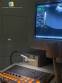 Ultrasound device for medical clinics Medison Sansung